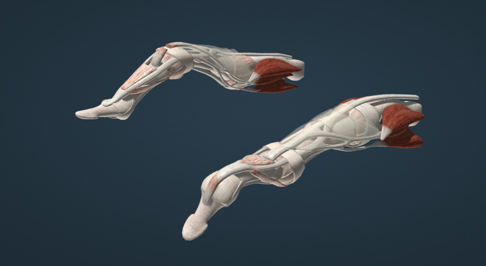 Swan-neck and boutonnière deformities