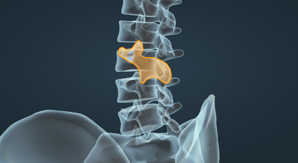 45° degrees oblique view of the lumbar spine