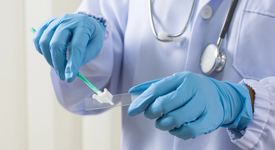 Cervical cancer screening performed by a registered nurse