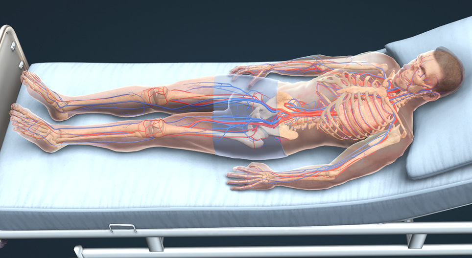 심부 정맥 혈전증 및 폐색전