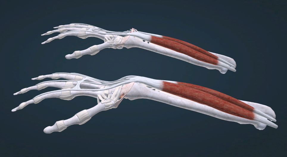 Caput ulnae syndrome