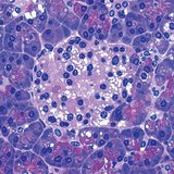 胰腺组的细胞生成胰岛素