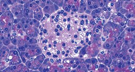 胰腺組的細胞生成胰島素