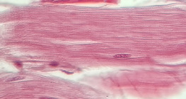 肌腱（縱截面）