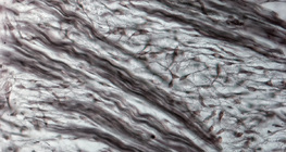 纖維軟骨組織（豬胚胎的鼻子）