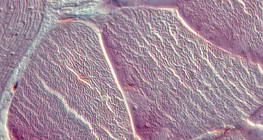 肌腱（橫截面）