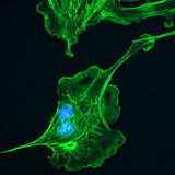 细胞骨架（在牛肺细胞中）