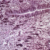 蜗牛脚的横截面