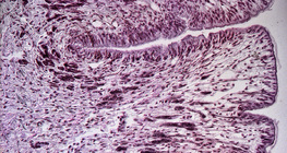 蜗牛脚的横截面