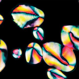 马铃薯里的淀粉粒