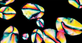 馬鈴薯裏的澱粉粒