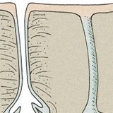 皮肤腺：皮脂腺