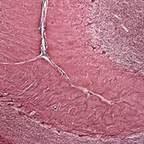 人类小脑的一部分