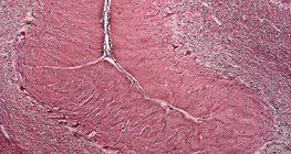 人類小腦的一部分