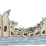 吸烟者呼吸道的纤毛上皮