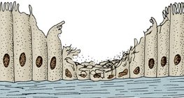 吸煙者呼吸道的纖毛上皮