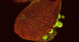 打开的紫茉莉花粉袋（共聚焦激光扫描显微镜）