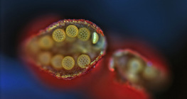 打开的紫茉莉花粉袋（光学显微镜）