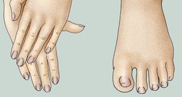 保持手脚的清洁