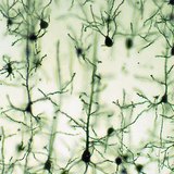 大脑皮层神经元