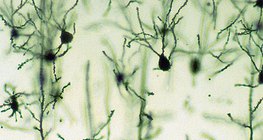 大腦皮層神經元