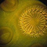 帶鈎和吸盤的頭節絛蟲（頭）