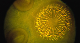 帶鈎和吸盤的頭節絛蟲（頭）