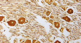 脊神經節上的神經細胞