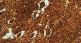 脊髓上的神經細胞（牛）