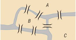 柯尼斯堡七橋問題
