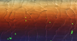 頭髮上在熒光下的大腸桿菌