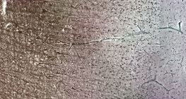 人类的大脑皮层与不同的细胞层