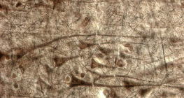 人类的大脑皮层巨锥体细胞