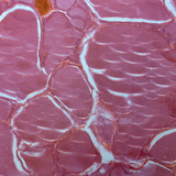 甲状腺的一部分