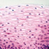 非角质化的复层鳞状