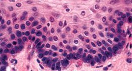 非角质化的复层鳞状