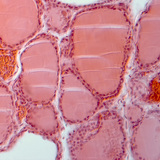 甲状腺的一部分