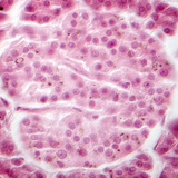 胰腺（相衬记录）-朗格汉斯岛细胞变暗