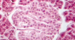 胰腺（相襯記錄）-朗格漢斯島細胞變暗