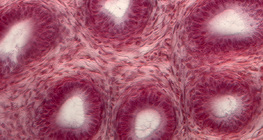 輸精管的橫截面