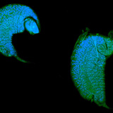 Iichneumon wasp larva developing as a parasite in drosophila pupa