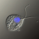 阴道毛滴虫的病原体（微分干涉相衬图像，细胞核染成蓝色）