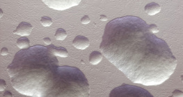 大肠杆菌菌落（不染色，白色）