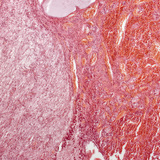 脑垂体（纵截面，低倍数放大）