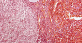 腦垂體（縱截面，低倍數放大）