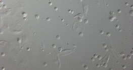 果蝇幼虫的红细胞