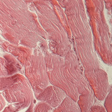 肌腱（横截面）