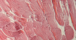 肌腱（橫截面）