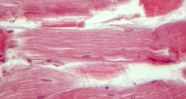 肌腱（縱截面）