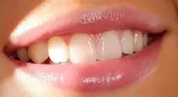 What do we know about teeth?